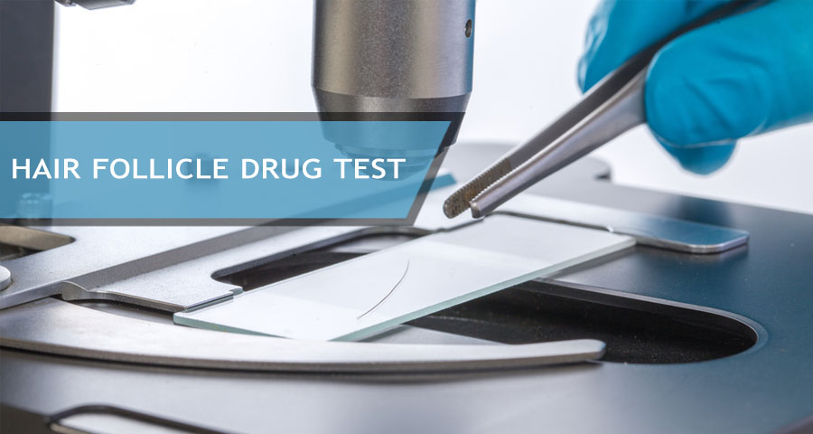 Hair Follicle Drug Test – Complete Guide, Tests Review